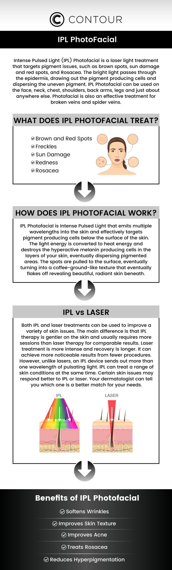 IPL (Intense Pulsed Light) treatments are designed to improve your skin's appearance by addressing sun damage, redness, and age spots. The cost of IPL (Intense Pulsed Light) treatments typically ranges from $200 to $500 per session. The cost of IPL can vary depending on the treatment area and the number of sessions needed. At Contour Medical Spa, our professional team will assess your individual needs and provide a customized treatment plan, ensuring that you receive the best possible care and results. For more information, contact us or book an appointment online. We are conveniently located at 18641 Devonshire Street Northridge, CA 91324.