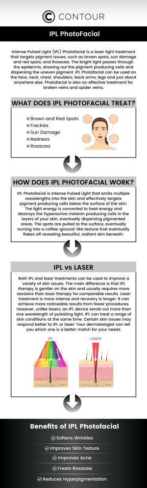 IPL (Intense Pulsed Light) treatments are designed to improve your skin's appearance by addressing sun damage, redness, and age spots. The cost of IPL (Intense Pulsed Light) treatments typically ranges from $200 to $500 per session. The cost of IPL can vary depending on the treatment area and the number of sessions needed. At Contour Medical Spa, our professional team will assess your individual needs and provide a customized treatment plan, ensuring that you receive the best possible care and results. For more information, contact us or book an appointment online. We are conveniently located at 18641 Devonshire Street Northridge, CA 91324.