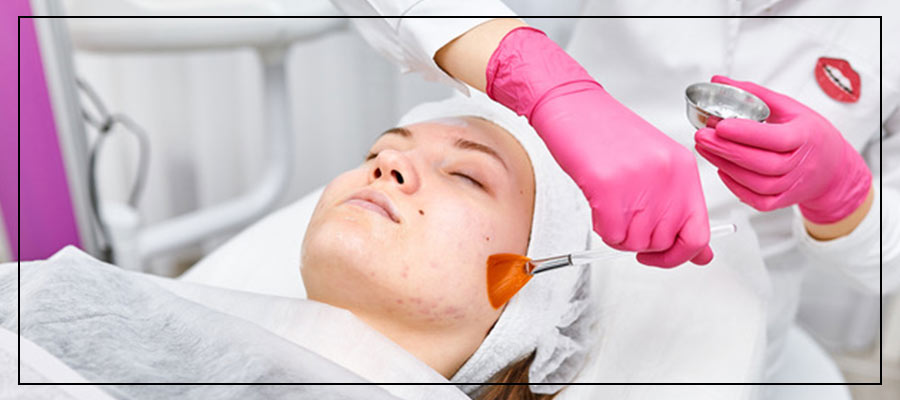 Laser Peels Specialist Near Me in Northridge, Los Angeles, CA Laser Peels Specialist Near Me in Northridge, Los Angeles, CA