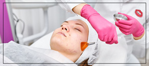 Laser Peels Specialist Near Me in Northridge, Los Angeles, CA Laser Peels Specialist Near Me in Northridge, Los Angeles, CA