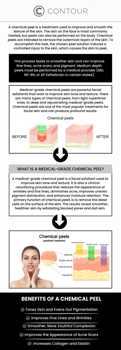 At Contour Medical Spa, Cecilia Scott, RN, BSN, provides professional chemical peel treatments designed to reveal smoother, clearer, and more youthful-looking skin. Before your peel, our team evaluates your skin type and goals to select the most suitable formula. After treatment, mild redness or flaking may occur as your skin renews itself, resulting in a fresh, radiant complexion. We ensure every client receives personalized care and guidance to achieve optimal post-peel recovery and long-lasting glow. For more information, contact us today or schedule an appointment online. We are conveniently located at 18641 Devonshire Street Northridge, CA 91324. At Contour Medical Spa, Cecilia Scott, RN, BSN, provides professional chemical peel treatments designed to reveal smoother, clearer, and more youthful-looking skin. Before your peel, our team evaluates your skin type and goals to select the most suitable formula. After treatment, mild redness or flaking may occur as your skin renews itself, resulting in a fresh, radiant complexion. We ensure every client receives personalized care and guidance to achieve optimal post-peel recovery and long-lasting glow. For more information, contact us today or schedule an appointment online. We are conveniently located at 18641 Devonshire Street Northridge, CA 91324.