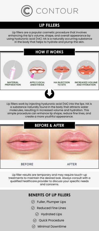 Seeing the results of lip filler treatments can be exciting, and understanding what to expect before and after your session helps set realistic goals. At Contour Medical Spa, clients can anticipate immediate improvements in lip volume and shape, with optimal results developing over the following days as swelling subsides. Our skilled team guides post-treatment care and schedules follow-ups to ensure your lips maintain a smooth, balanced, and natural appearance. For more information, contact us today or request an appointment online. We are conveniently located at 18641 Devonshire Street, Northridge, CA 91324. Seeing the results of lip filler treatments can be exciting, and understanding what to expect before and after your session helps set realistic goals. At Contour Medical Spa, clients can anticipate immediate improvements in lip volume and shape, with optimal results developing over the following days as swelling subsides. Our skilled team guides post-treatment care and schedules follow-ups to ensure your lips maintain a smooth, balanced, and natural appearance. For more information, contact us today or request an appointment online. We are conveniently located at 18641 Devonshire Street, Northridge, CA 91324.